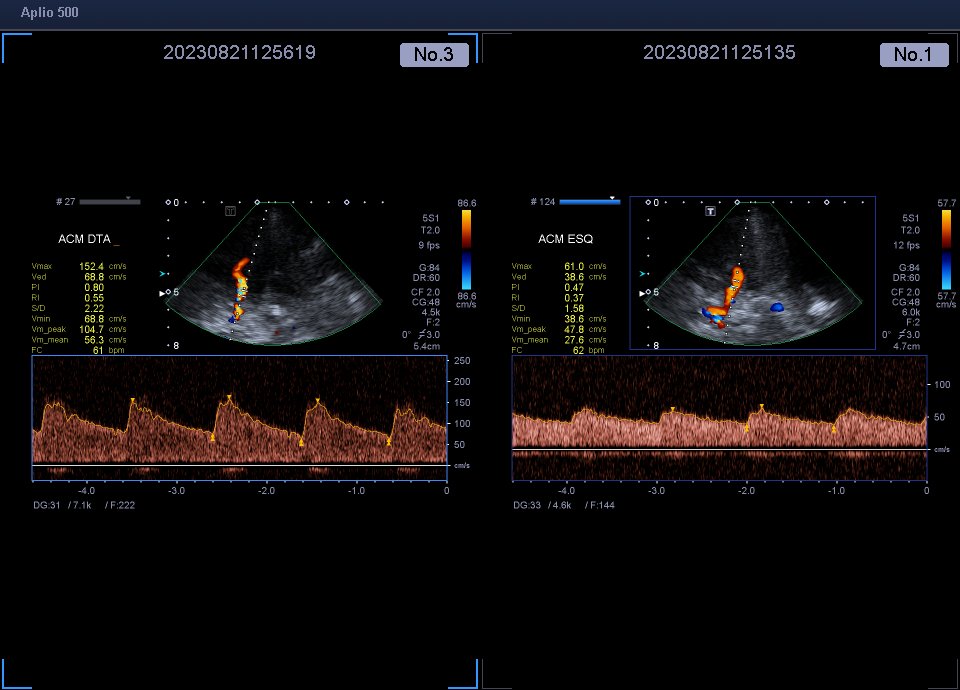 Neurosonology Lab - LHC tweet media