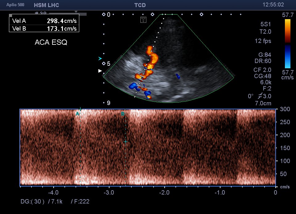 Neurosonology Lab - LHC tweet media