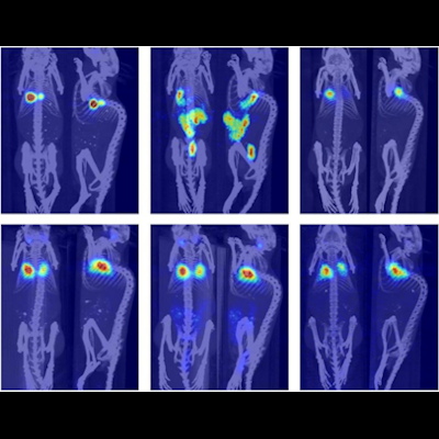 AuntMinnie's tweet photo. PET scans may be able to help assess the threat that microplastics pose to human health, according to a recent study. #radiology #MolecularImaging #nuclearmedicine https://t.co/V6nbZLwzUW https://t.co/bw1co8BRKQ