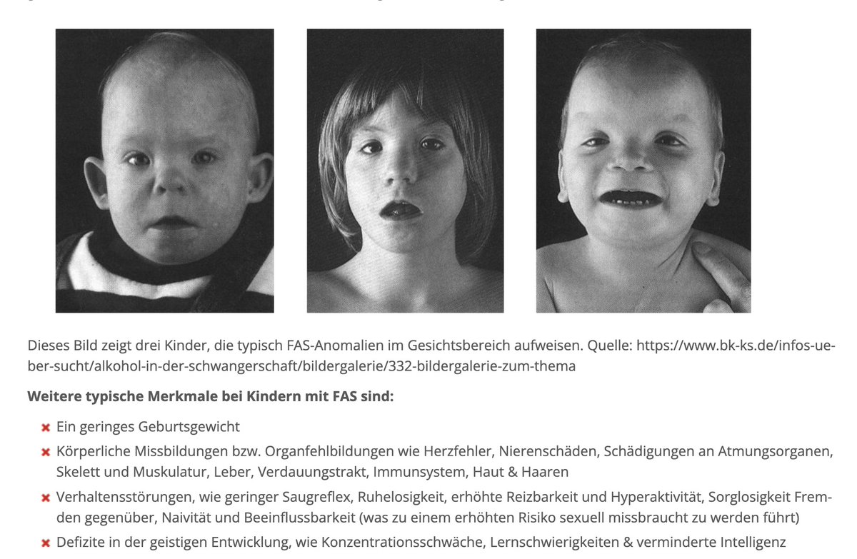 #Alkohol in der Schwangerschaft ist der häufigste Grund für nicht genetische #Behinderungen. Schätzungen zufolge kommen jährlich etwa 10.000 Babys mit alkoholbedingten Schädigungen auf die Welt.
🥦
#FaetalesAlkoholSyndrom