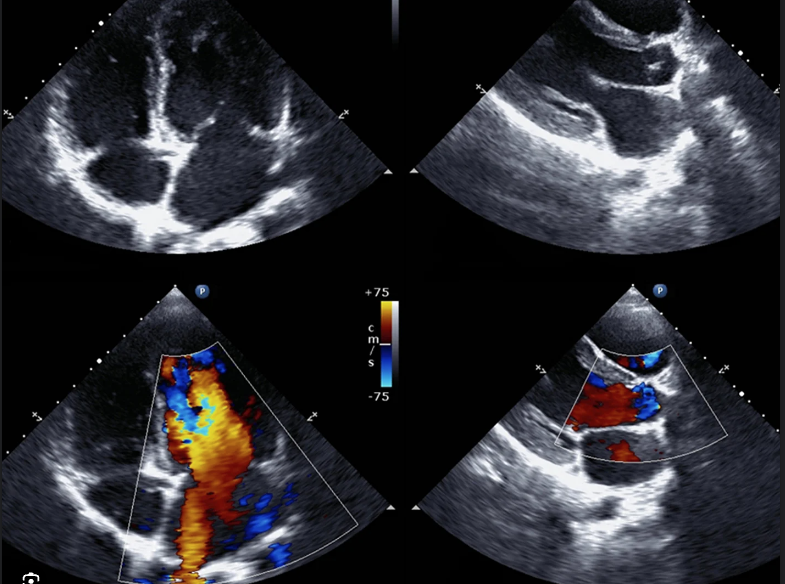 𝙲𝚒𝚊𝚗𝙼𝚌𝙳𝚎𝚛𝚖𝚘𝚝𝚝 (@cianmcdermott) on Twitter photo Want to improve your ultrasound and #echofirst skills with a view to accreditation? 
Check out VTEDublin.org for FAMUS & FUSIC Heart registration
eventbrite.ie/e/fusic-heart-…
eventbrite.ie/e/famus-ultras… Want to improve your ultrasound and #echofirst skills with a view to accreditation? 
Check out VTEDublin.org for FAMUS & FUSIC Heart registration
eventbrite.ie/e/fusic-heart-…
eventbrite.ie/e/famus-ultras…