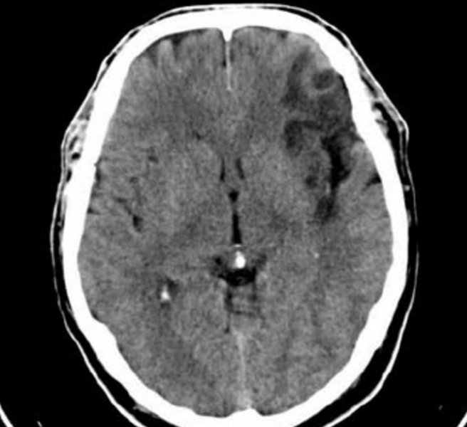 Timothy Li tweet media