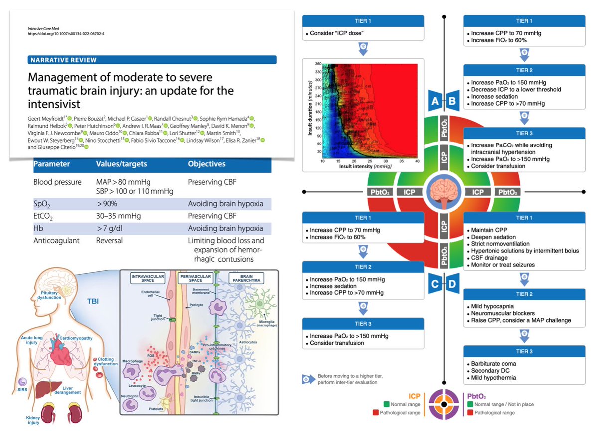 yourICM's tweet image. 🧠 Here recent neuro-narrative reviews… 🔓 #FOAMcc on @yourICM 
📖 EEG in #ICU for acute BI rdcu.be/dj1PO
📖 Managing moderate/severe TBI rdcu.be/cN2rq
📖 Hypoxic–ischaemic BI after CA rdcu.be/dh3Gd
📖 The brain in #PedsICU  rdcu.be/cLS1v