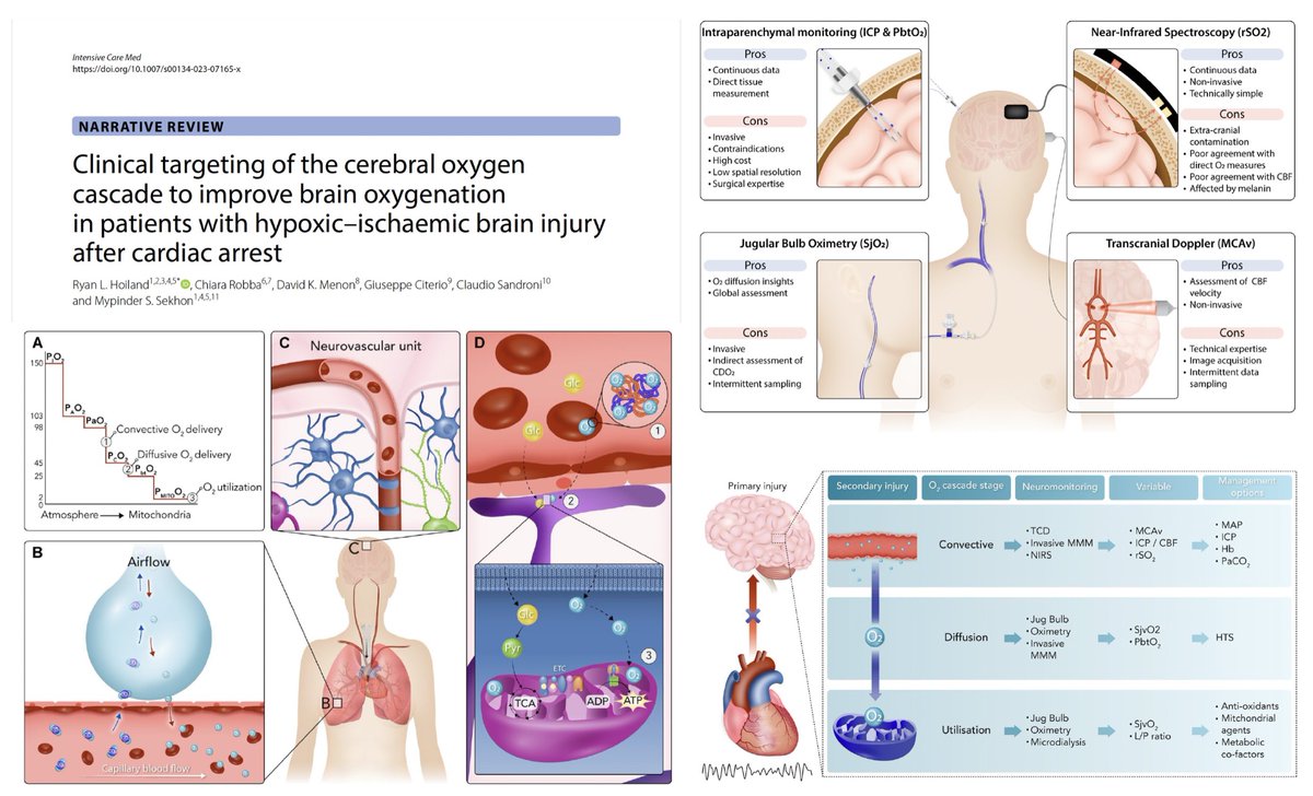 yourICM's tweet image. 🧠 Here recent neuro-narrative reviews… 🔓 #FOAMcc on @yourICM 
📖 EEG in #ICU for acute BI rdcu.be/dj1PO
📖 Managing moderate/severe TBI rdcu.be/cN2rq
📖 Hypoxic–ischaemic BI after CA rdcu.be/dh3Gd
📖 The brain in #PedsICU  rdcu.be/cLS1v
