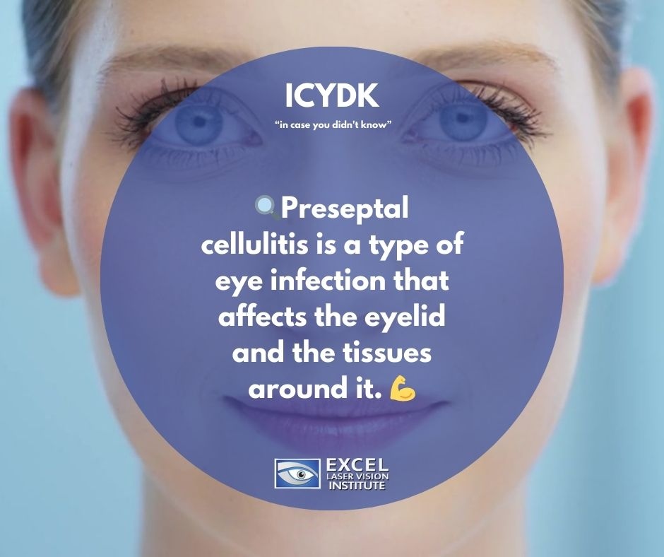 Excel_Eye's tweet photo. 🔍Preseptal cellulitis is a type of eye infection that affects the eyelid and the tissues around it. 💪

🕵️‍♀️Most often, it's caused by a bacterial infection that starts from a minor injury or even a simple bug bite.

#incaseyoudidnotknow #incaseyoudontknow https://t.co/CZnuudojtI