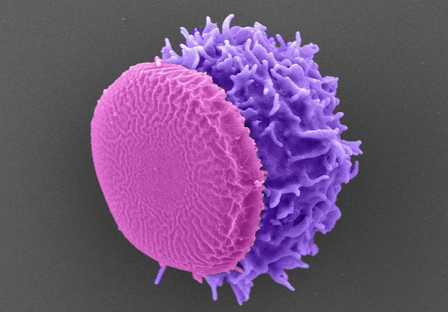 Samir Mitragotri (@smitragotri) on Twitter photo Curious how backpacks on cells look like? Here’s a colorized SEM of a backpack on a T cell. Backpacks are discoidal polymer particles that are large enough to support the cell, but small enough to migrate with the cell <a href="/wyssinstitute/">Wyss Institute</a> Image: <a href="/griffbibbey/">Griff Bibbey</a> <a href="/Syoug_Shaha/">SUYOG GIRISH SHAHA</a> <a href="/hseas/">Harvard SEAS</a> Curious how backpacks on cells look like? Here’s a colorized SEM of a backpack on a T cell. Backpacks are discoidal polymer particles that are large enough to support the cell, but small enough to migrate with the cell <a href="/wyssinstitute/">Wyss Institute</a> Image: <a href="/griffbibbey/">Griff Bibbey</a> <a href="/Syoug_Shaha/">SUYOG GIRISH SHAHA</a> <a href="/hseas/">Harvard SEAS</a>
