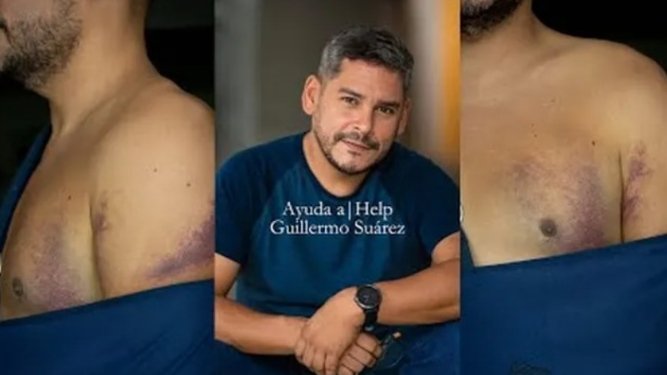 El amigo y fotoperiodista <a href="/guillesuarez/">Guille A. Suárez P.</a> requiere con urgencia una operación en su hombro izquierdo. Es la garantía de que pueda volver a tomar su cámara. 
Gofundme: gofund.me/6528e24e
Zelle: guillesuarezp@gmail. com
Pago móvil: Mercantil, CI V-11937992, Telf. 04241935070