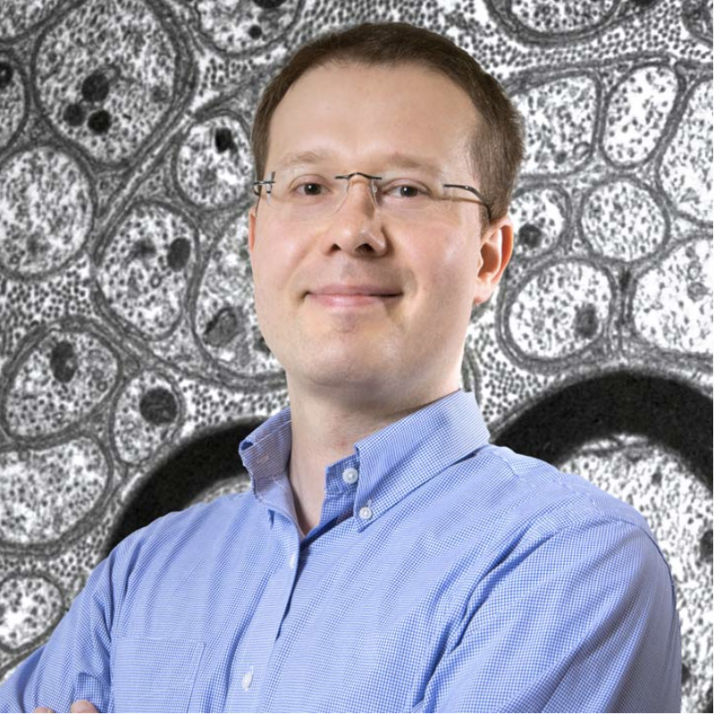 Ohio State Chronic Brain Injury Program (@ohiostatecbi) on Twitter photo August’s #CBISpotlight is Bogdan Beirowski, MD, PhD (<a href="/OhioStateNeuro/">OSU Department of Neurology and Residency Program</a>, @OSUNeuroInst) 🎉🥳 His lab (axonglia.com, <a href="/ElisabettaBabe1/">Elisabetta Babetto</a>) studies #metabolic axon-glia interactions to protect axons from #neurodegeneration 🧠 View the full feature at go.osu.edu/CBI ⬅️ August’s #CBISpotlight is Bogdan Beirowski, MD, PhD (<a href="/OhioStateNeuro/">OSU Department of Neurology and Residency Program</a>, @OSUNeuroInst) 🎉🥳 His lab (axonglia.com, <a href="/ElisabettaBabe1/">Elisabetta Babetto</a>) studies #metabolic axon-glia interactions to protect axons from #neurodegeneration 🧠 View the full feature at go.osu.edu/CBI ⬅️