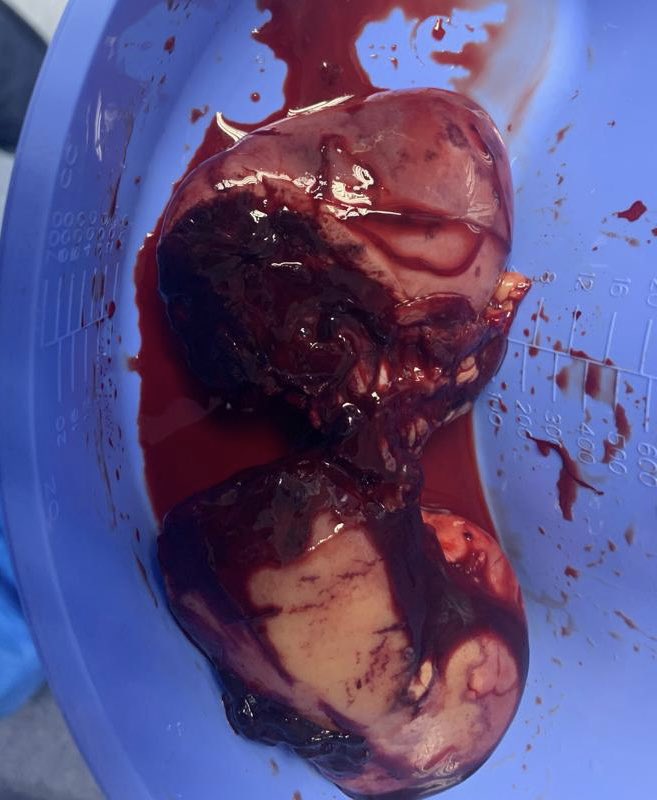 Edgar Iván Bravo 🇲🇽😬🤘🏻 tweet media