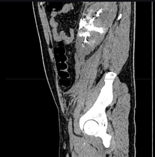 Edgar Iván Bravo 🇲🇽😬🤘🏻 tweet media