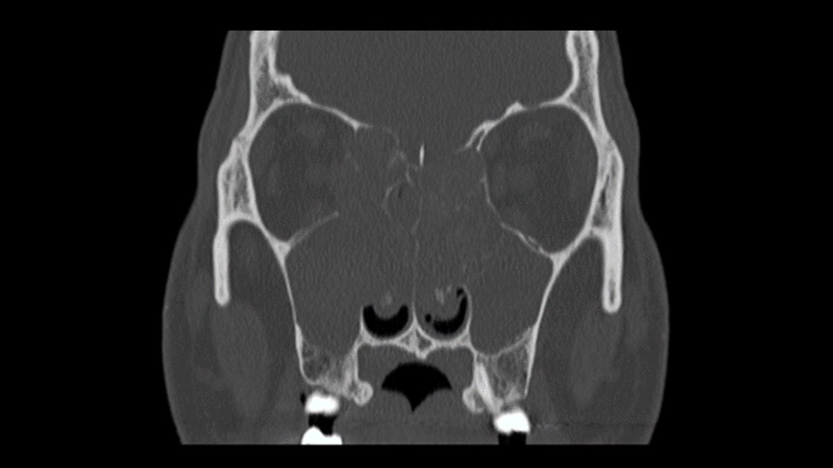 John Craig, MD tweet media