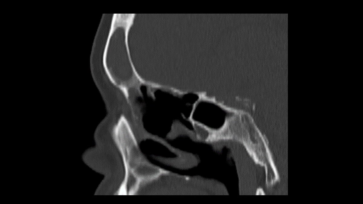 John Craig, MD tweet media