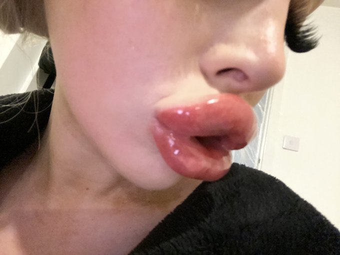 Do you like girls with big lips 👄   #fakelips #lipfiller https://t.co/hXIyVsF8Aa<a href="/tag/fakelips"class="tags">#fakelips</a><a href="/tag/lipfiller"class="tags"><span>#lipfiller</span></a>
