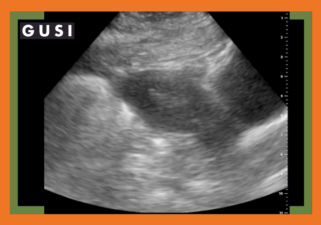 Global Ultrasound Institute tweet media