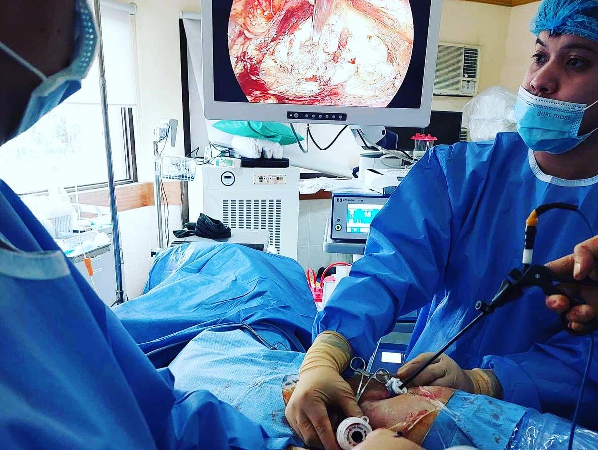 Karl Tan, MD (Endouro) 🇵🇭 (@iamdockarl) on Twitter photo First (?) Retroperineoscopic Radical Nephrectomy in Lipa Medix. We had fun doing the procedure, nice anatomy despite the large BMI 😯 lucky the trocar reached the space! #endourology #exoluminal #laparoscopy #urologylife #endourology #exoendo First (?) Retroperineoscopic Radical Nephrectomy in Lipa Medix. We had fun doing the procedure, nice anatomy despite the large BMI 😯 lucky the trocar reached the space! #endourology #exoluminal #laparoscopy #urologylife #endourology #exoendo