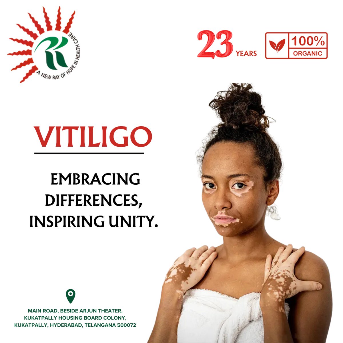 rkayurvedic_hyd's tweet image. Vitiligo Treated at RK Ayurvedic 

Diversity is our strength, and unity is our power. At RK Ayurvedic, we celebrate the uniqueness of every individual and empower those who seek to embrace their differences.

#RKAyurvedic #EmbraceDifferences #InspireUnity #NaturalBeauty #Restore