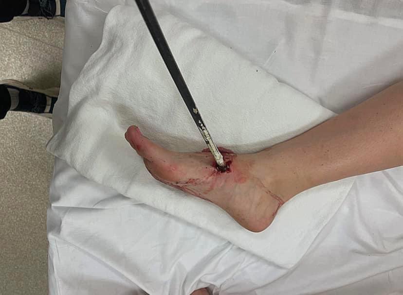 Pro tip: check the yard REALLY well before you start mowing.