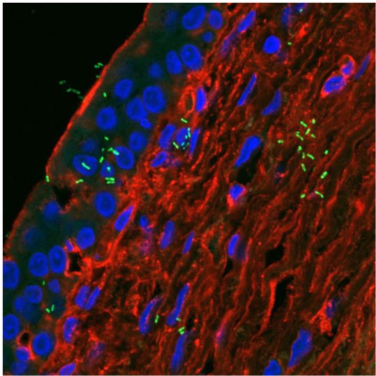 And here is how these embedded bladder bacteria look (stained in green) in case you want to see for yourself!