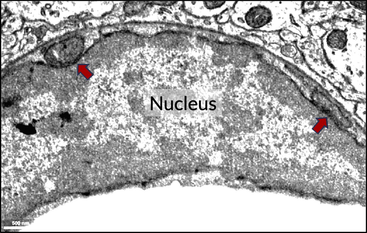 HaniehFalahati's tweet image. This #EM_Monday is about mitochondria-nuclear envelope contacts in different brain cells. There are many reasons for mito and NE to want to have direct lines of communications: from coordinating response to cellular stress to transport of lipids and even proteins. However, (1/n)