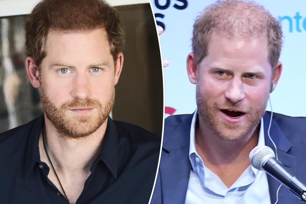 PageSix's tweet photo. Prince Harry’s luscious new hair chopped by critics: ‘Looks like a fool’ https://t.co/absgw1V1Is https://t.co/e9f3U1Nipz