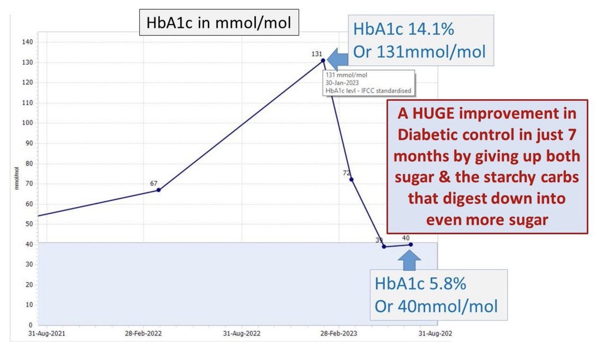 From very severe T2diabetes to normal blood sugars A HUGE IMPROVEMENT IN 7 MONTHS 😊using diet not drugs. This works because often it is a sugary diet that puts up blood sugar. If diet is the problem it is also the solution. We published how we do it here nutrition.bmj.com/content/early/…