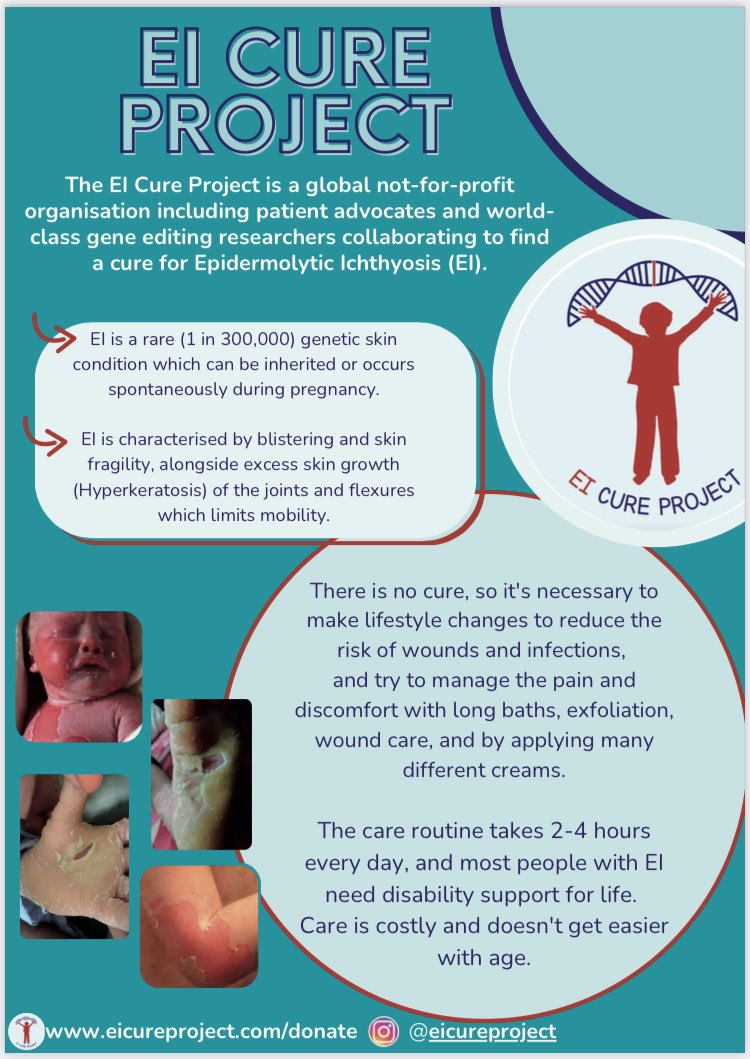 EI_cure_project's tweet image. I’m delighted to introduce our new Flyer 😍

The latest promotion…

Would you like to NAME a PhD Scholarship? ✅

Wouldn’t that be amazing, to become a part of life-changing research! 🥳

#eicureproject #ichthyosis #dermatology #geneediting #raredisease #findacure #notforprofit