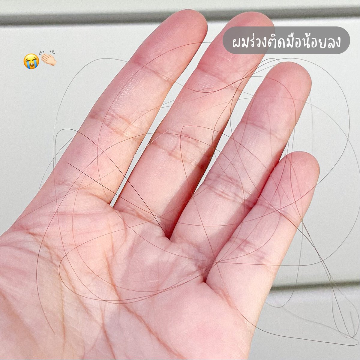 gmmgamm's tweet photo. เจออีกหนึ่งของดีละ วิตามินบำรุงผมของหมอทิว MORTIW ช่วยลดผมร่วง+บำรุงผม ส่วนตัวว่ากินแล้วลูกผมขึ้นเยอะ เส้นผมเงางามขึ้นด้วยยยย เลยให้คุณแม่ทานด้วย นางบอกผมหงอกช้าลง!
พิกัด : https://t.co/UhIQEX6eZB
#หมอทิว #mortiw #HERA #บำรุงผม #ผมร่วง #ผมบาง https://t.co/vv6W1At9KS