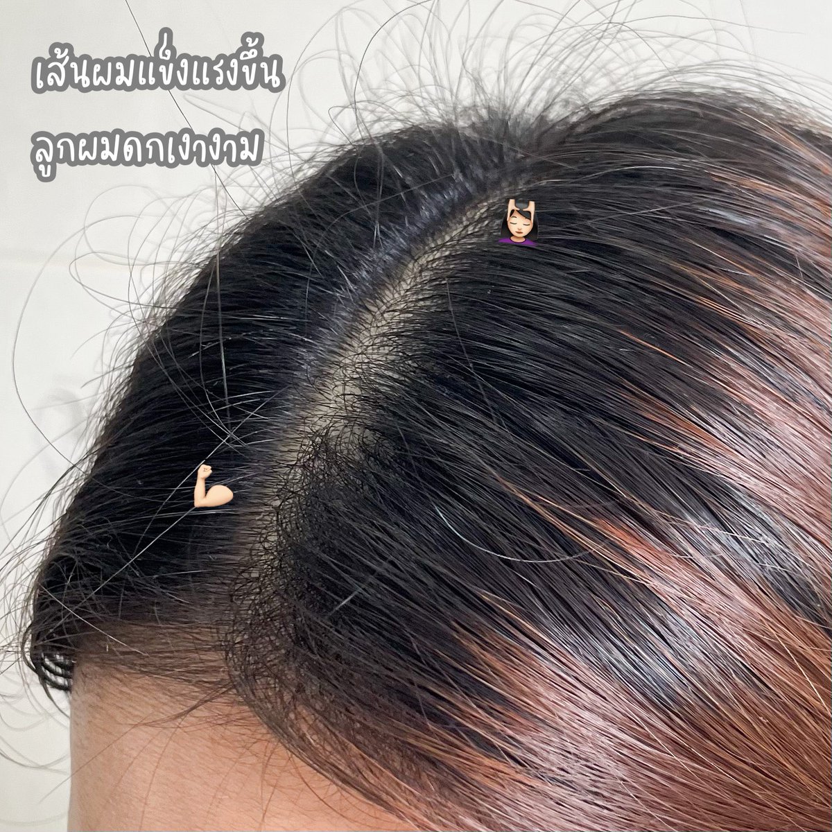 gmmgamm's tweet photo. เจออีกหนึ่งของดีละ วิตามินบำรุงผมของหมอทิว MORTIW ช่วยลดผมร่วง+บำรุงผม ส่วนตัวว่ากินแล้วลูกผมขึ้นเยอะ เส้นผมเงางามขึ้นด้วยยยย เลยให้คุณแม่ทานด้วย นางบอกผมหงอกช้าลง!
พิกัด : https://t.co/UhIQEX6eZB
#หมอทิว #mortiw #HERA #บำรุงผม #ผมร่วง #ผมบาง https://t.co/vv6W1At9KS