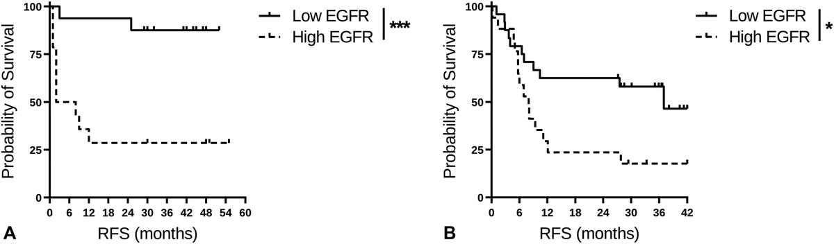 TeresaSAmaral's tweet photo. Does #EGFR play a role in #melanoma?
We looked for #EGFR expression in treatment-naive melanoma #metastases &amp; our results show that EGFR expression is associated with #relapse in #patients w/ melanoma receiving #adjuvant PD-1 based ICI
https://t.co/qIQdaNc4a5 https://t.co/eAcLKz5a2f