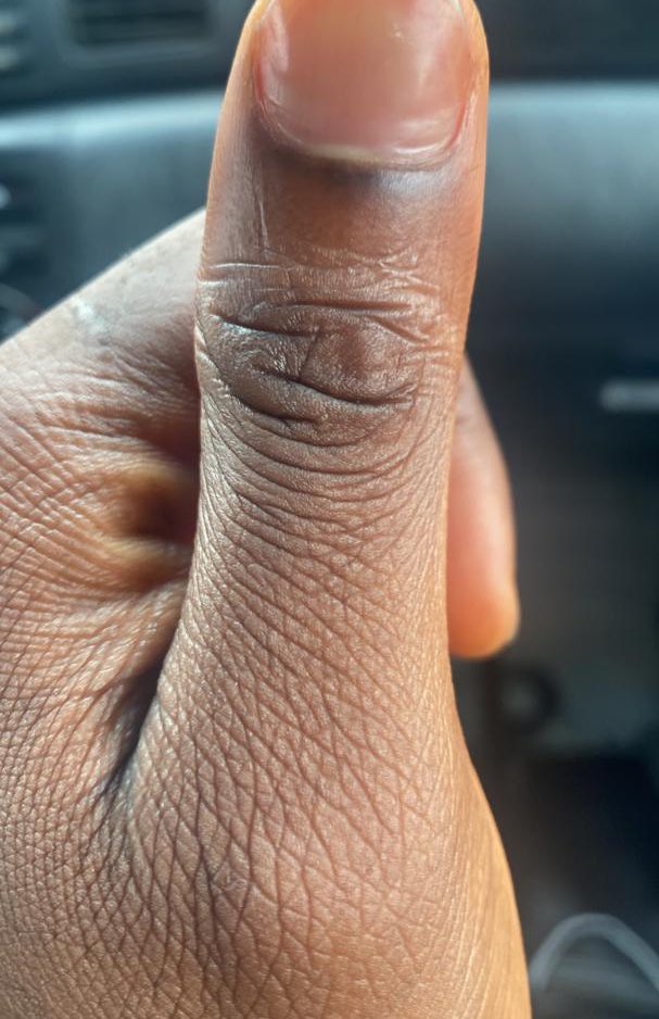 EricaNlewedim's tweet photo. This is my daddy’s thumb, what initials do you see? I need to be sure of something 🤭 https://t.co/bFB7ps4GkK