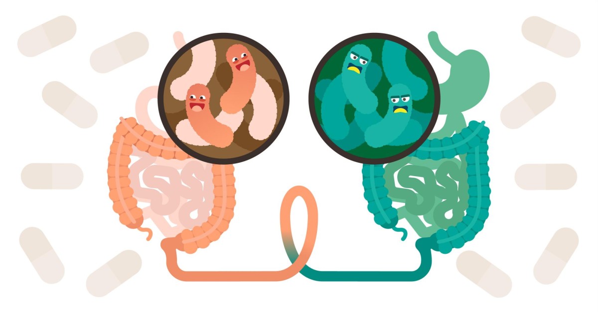 Científicos evalúan potencial de la microbiota intestinal para el tratamiento del cáncer
La vpdta sect  <a href="/Gabrielasjr/">Gabriela Jiménez</a>,indicó que la microbiota intestinal continúa siendo de gran complejidad debido a la multitud de especies que posee
<a href="/Merlicg1/">🍃🌷ɢµєʀʀєʀɑ ʍєʀℓɨςɢ🍃🌹</a>
<a href="/MaestraTuitera/">Miriam Mayorga</a>
#ConsensoDeVenezuela
