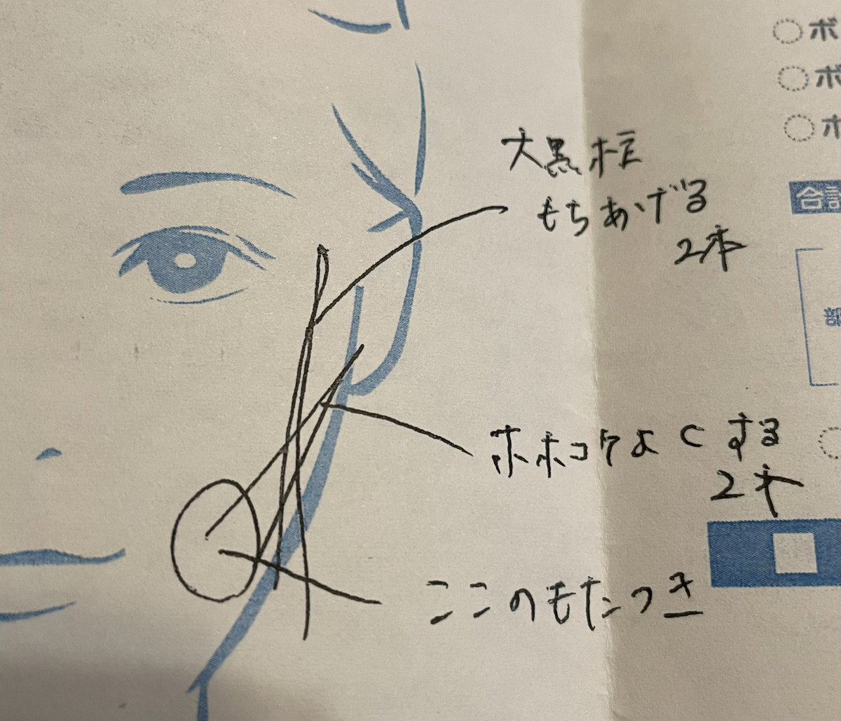 creampuff0530's tweet photo. 約半年ぶりに糸リフトしてきた🏥
斜め上に2本、縦に2本で針穴は耳の前とこめかみの2箇所
重心がしっかり上に上がって面長感が無くなった🙌
これだから糸はやめられない✨びっくりするほど腫れてないし、先生の人柄も素敵で安心してお任せできた👩‍⚕️ https://t.co/KIaQDAhz0G