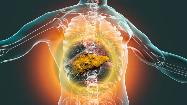 medflixs's tweet photo. #SantePublique
Le score LiverRisk est capable de prédire la fibrose hépatique et le développement de maladies hépatiques pour mettre en place les mesures adaptées 👇 
https://t.co/4Oo4ZUqO7n https://t.co/tyn6DTNsAa