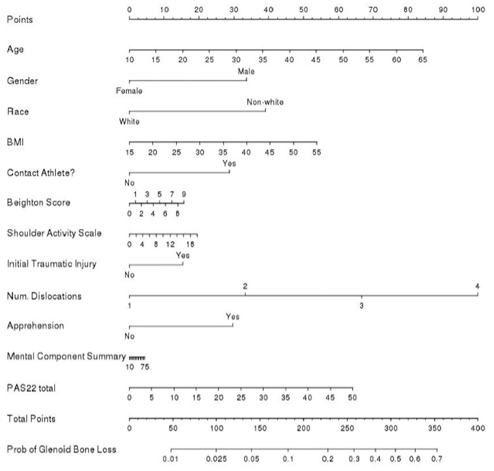 MoAImam's tweet photo. This study from @MOON_Shoulder
shows that the strongest predictor of bone loss in patients with anterior instability is the number of dislocations; with each subsequent dislocation, the risk for bone loss increases significantly.  #shoulderinstability https://t.co/75c9TYy4V6 https://t.co/itI4levRTX