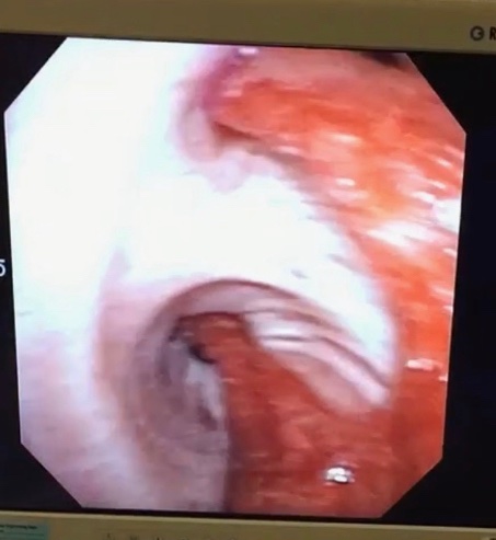 NavinKapur4's tweet photo. Pulmonary artery catheters are not benign. If you don’t have equipoise about PAC use in HF and #shock get some. If you do then join us and randomize in the #PACCS trial led by the #CSWG

https://t.co/k8jajSgmwq https://t.co/3oYiDkYuF7