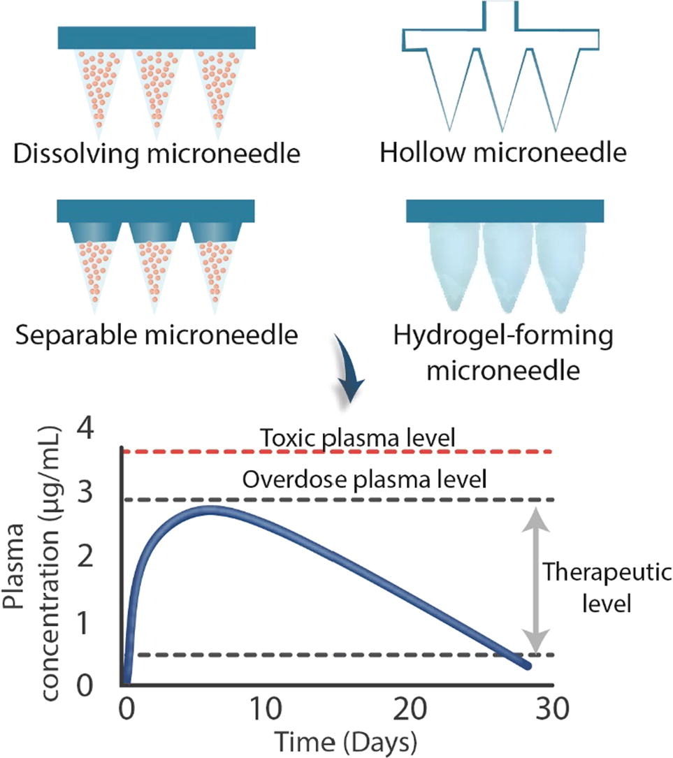 PharmaExcipients (@pharmaexcipient) on Twitter photo Long-acting microneedle formulations by <a href="/lalitkvora/">Lalitkumar Vora</a> <a href="/AkmallHidayat/">Akmal Hidayat Sabri</a> <a href="/ryanfdonnelly/">Ryan Donnelly</a> et al.
This review provides insight to formulators that the selection of materials in tandem with refined design may offer an approach to achieve sustained MN delivery. pharmaexcipients.com/news/long-acti… Long-acting microneedle formulations by <a href="/lalitkvora/">Lalitkumar Vora</a> <a href="/AkmallHidayat/">Akmal Hidayat Sabri</a> <a href="/ryanfdonnelly/">Ryan Donnelly</a> et al.
This review provides insight to formulators that the selection of materials in tandem with refined design may offer an approach to achieve sustained MN delivery. pharmaexcipients.com/news/long-acti…