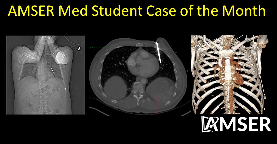 👀Check out our Med Student Case of the Month website for many interesting cases (Chest, GI, GU, MSK, Neuro) for the month of August!

aur.org/case-of-the-mo…

#MedStudentTwitter #futureradres #RadEd #radiology