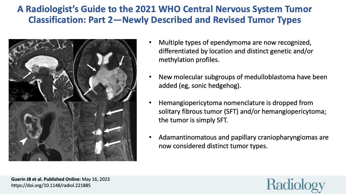 In this week's @radiology_rsna podcast, @juliebguerin speaks about the WHO central nervous system tumor classification (part 2 - beyond infiltrating glioma) Article: doi.org/10.1148/radiol… Podcast: rsnaradiology.libsyn.com/who-cns-tumor-… 🧵