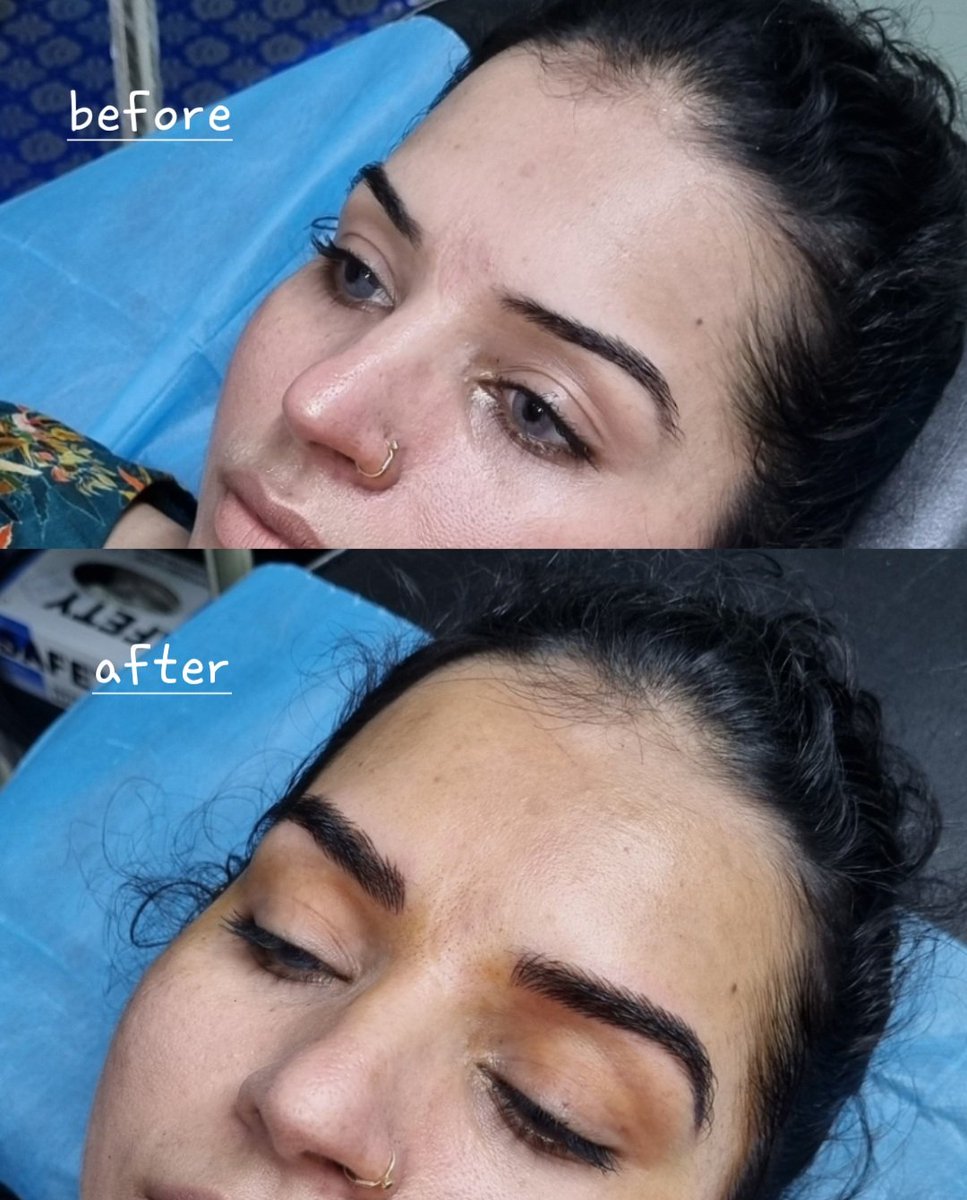 Es0t3ric's tweet photo. Brow transformation 🥰🥰
#microblading 
#semipermanentmakeup https://t.co/KizxdLtJEc
