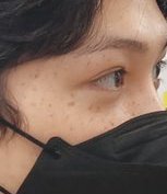 BBOKARILOOKS's tweet photo. felix heart shaped freckle 🥺 https://t.co/rqPCtNhADB