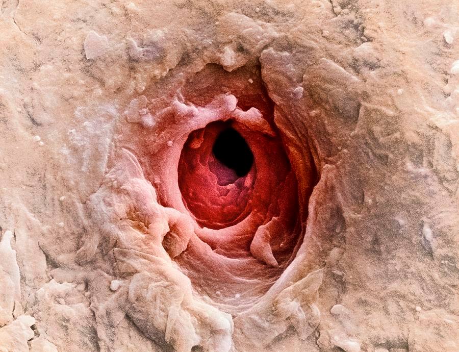 Bio_comunidad's tweet image. _
Así es como se ve un poro sudoríparo de la piel humana, visto desde un microscopio electrónico de barrido.

Estos pequeños orificios están en todas partes, cubriendo la piel de su cara, brazos, piernas y cualquier otra parte de su cuerpo. Los poros cumplen una función…