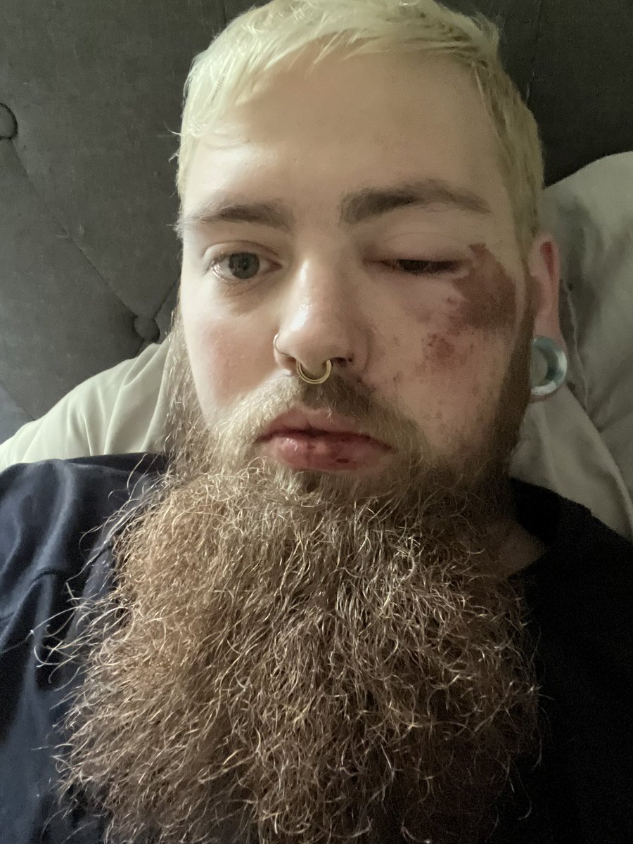 pay4456's tweet photo. It’s been a long recovery from being jumped but I’m back to my old self. It only took a month and a little self care. I https://t.co/FFtPGuSwMY