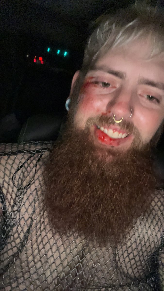 pay4456's tweet photo. It’s been a long recovery from being jumped but I’m back to my old self. It only took a month and a little self care. I https://t.co/FFtPGuSwMY