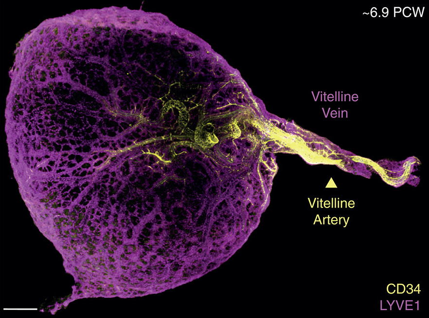 The human yolk sac is a key staging ground for an array of vital organ functions during development in utero. Learn more in a new Science study: scim.ag/3Pb