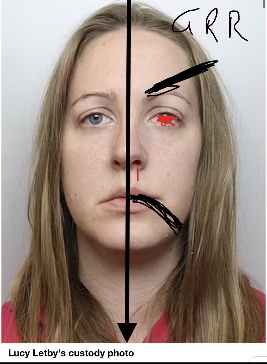 BadHealthAdvice's tweet photo. @laurarichards99 Agreed, how can nobody see the difference? https://t.co/JglAAYx8Yn