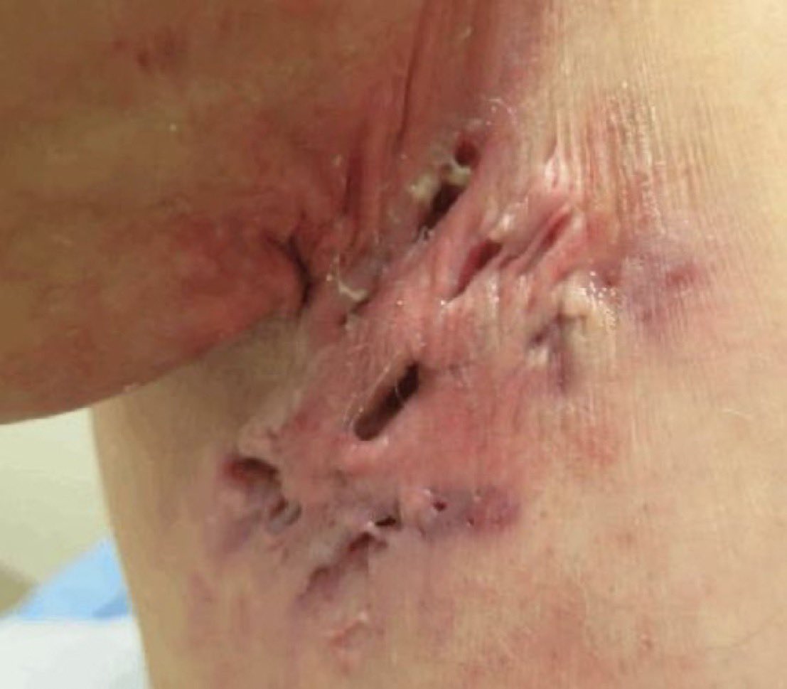 Journal of Brown Hospital Medicine tweet media