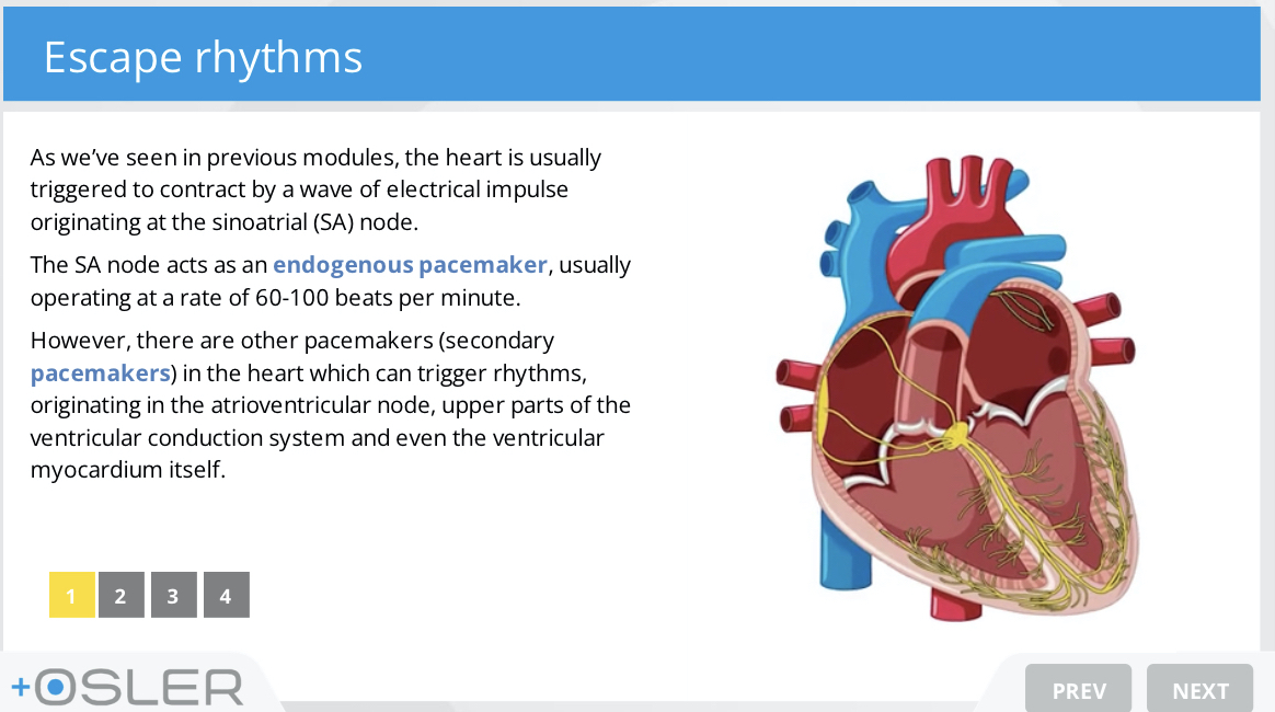 oslertech's tweet photo. Great new module - the emergency management of severe bradycardia
https://t.co/n1H8cmivnl
Like all Osler content and features, it's 100% free!
#meded #medtwitter #FOAMed #FOAMcc #FOAMresus #FOAMems #juniordoctors #tipsfornewdocs #tipsfornewinterns #doctors #emergencymedicine #intensivecare #ICU #emergencyphysician #intensivst #resuscitation #advancedlifesupport #ALS