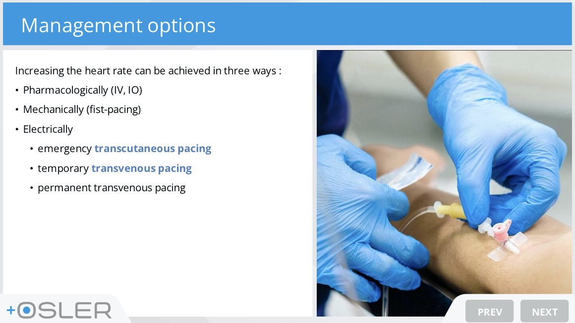 oslertech's tweet photo. Great new module - the emergency management of severe bradycardia
https://t.co/n1H8cmivnl
Like all Osler content and features, it's 100% free!
#meded #medtwitter #FOAMed #FOAMcc #FOAMresus #FOAMems #juniordoctors #tipsfornewdocs #tipsfornewinterns #doctors #emergencymedicine #intensivecare #ICU #emergencyphysician #intensivst #resuscitation #advancedlifesupport #ALS