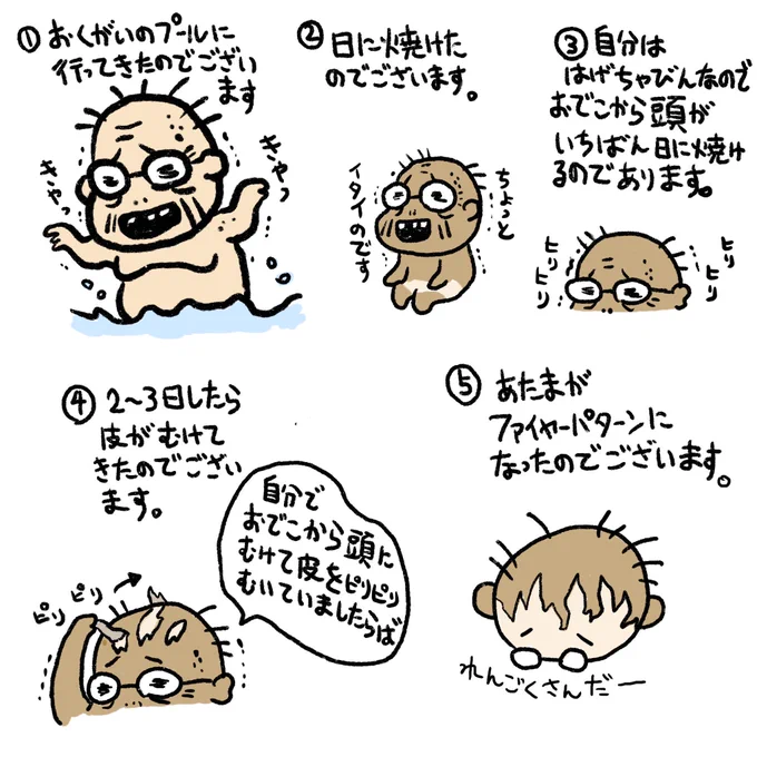 日に焼けたのでございます。 