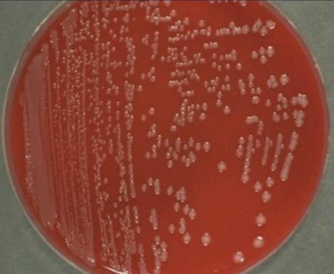 Indiana University Infectious Diseases Fellowship tweet media